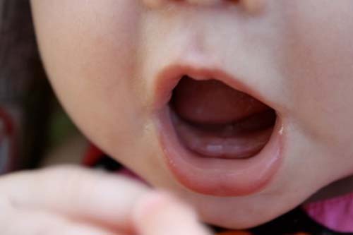Trẻ bị sốt khi mọc răng